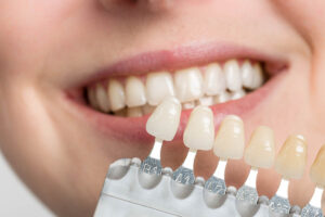 Veneers, Crowns, or Implants: Which Treatment Is Right for Your Smile?